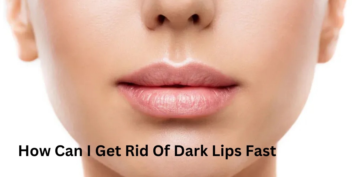 How Can I Get Rid Of Dark Lips Fast